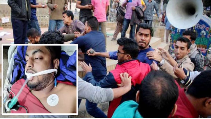 নুরের অবস্থা অপরিবর্তিত