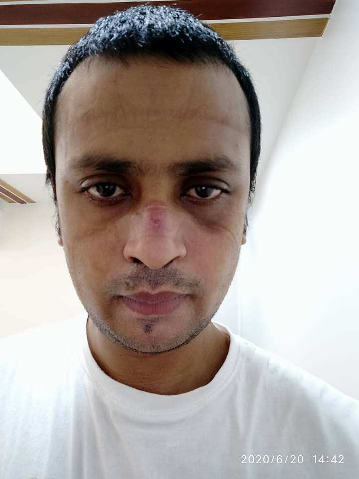 প্রকৃতির দেয়া অফুরন্ত অক্সিজেন টেনে নিতে না পারার কষ্ট…