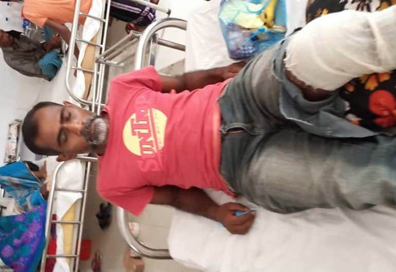 বানারীপাড়ায় আ’লীগ নেতাকে পিটিয়ে পা ভেঙ্গে দিয়েছে চেয়ারম্যান