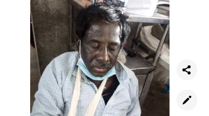 নলছিটিতে প্রার্থীর হাত ভেঙ্গে দিল মেম্বার
