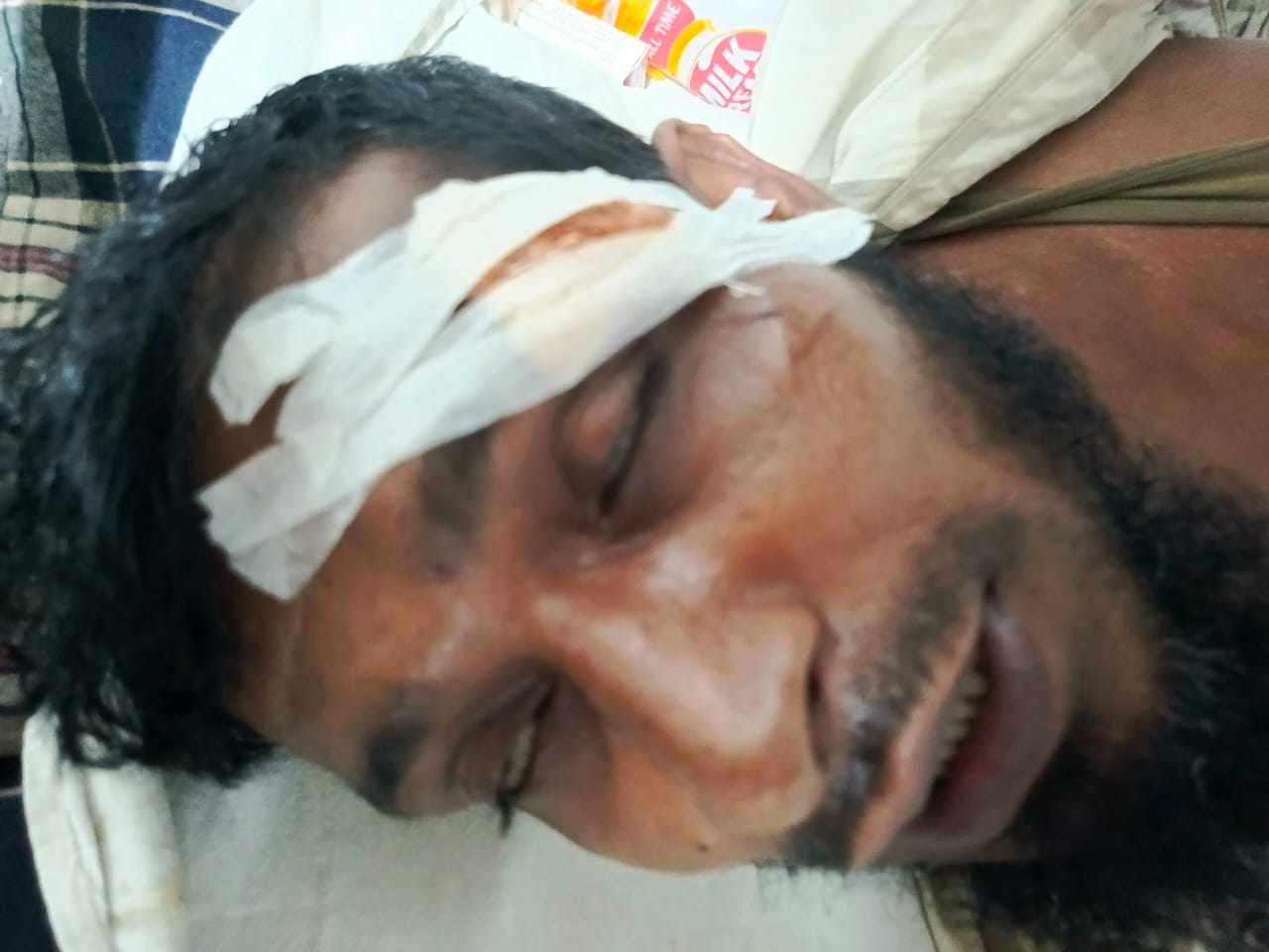 বোরহানউদ্দিনে পূর্ব শত্রুতার জেরে হামলা,থানায় অভিযোগ আহত ১