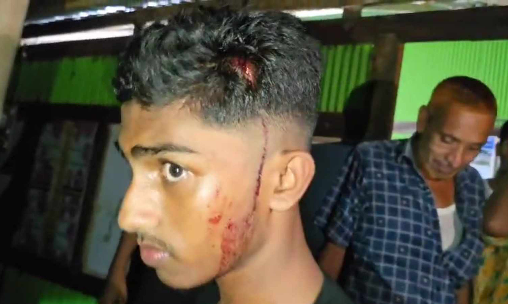 গোপালগঞ্জে ফুটবল খেলাকে কেন্দ্র করে দুই পক্ষের সংঘর্ষ; আহত ২০