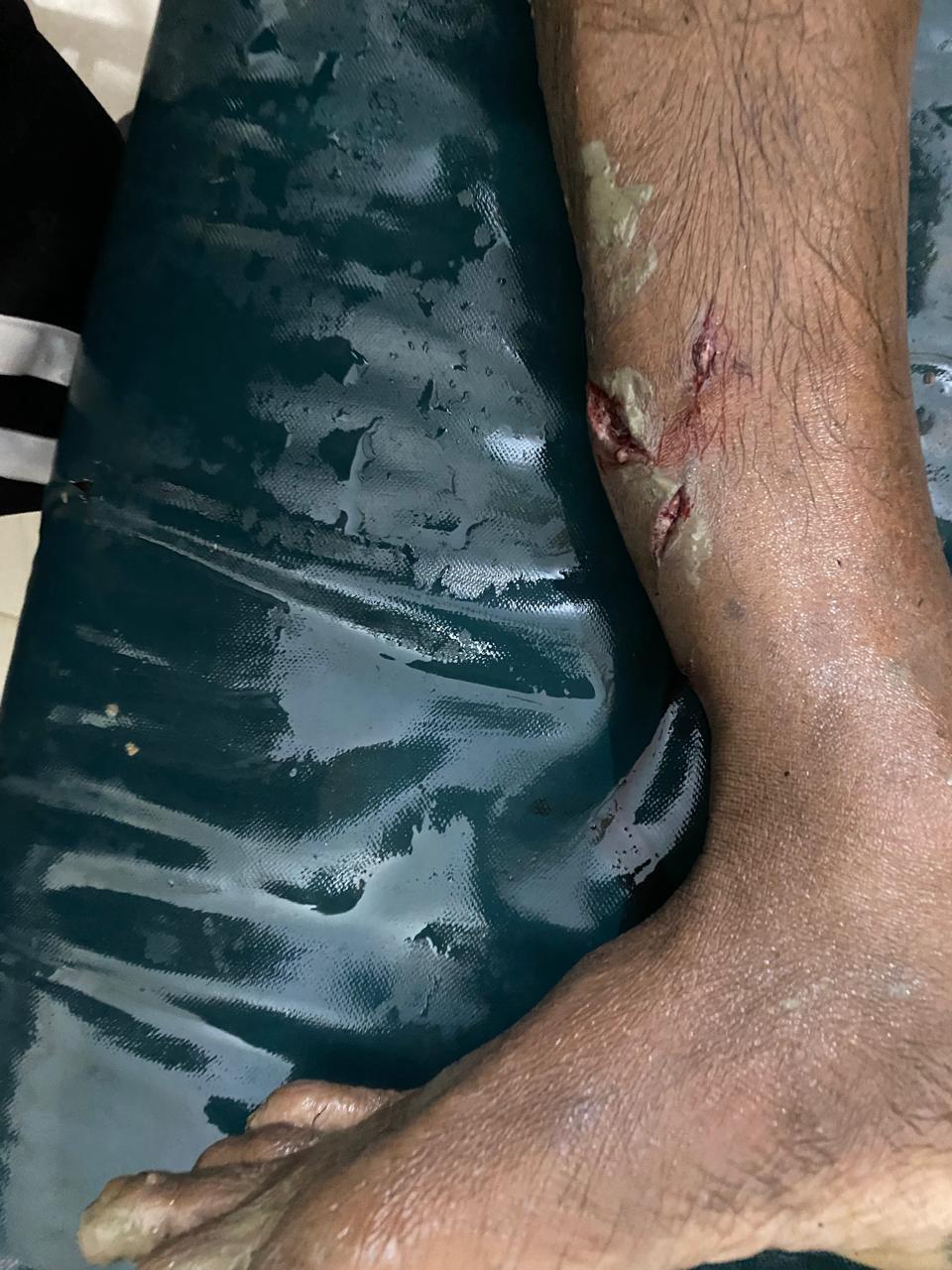 বরগুনায় পূর্ব শত্রুতার জেরে পাথরঘাটায় জেলেকে কুপিয়ে হত্যা 