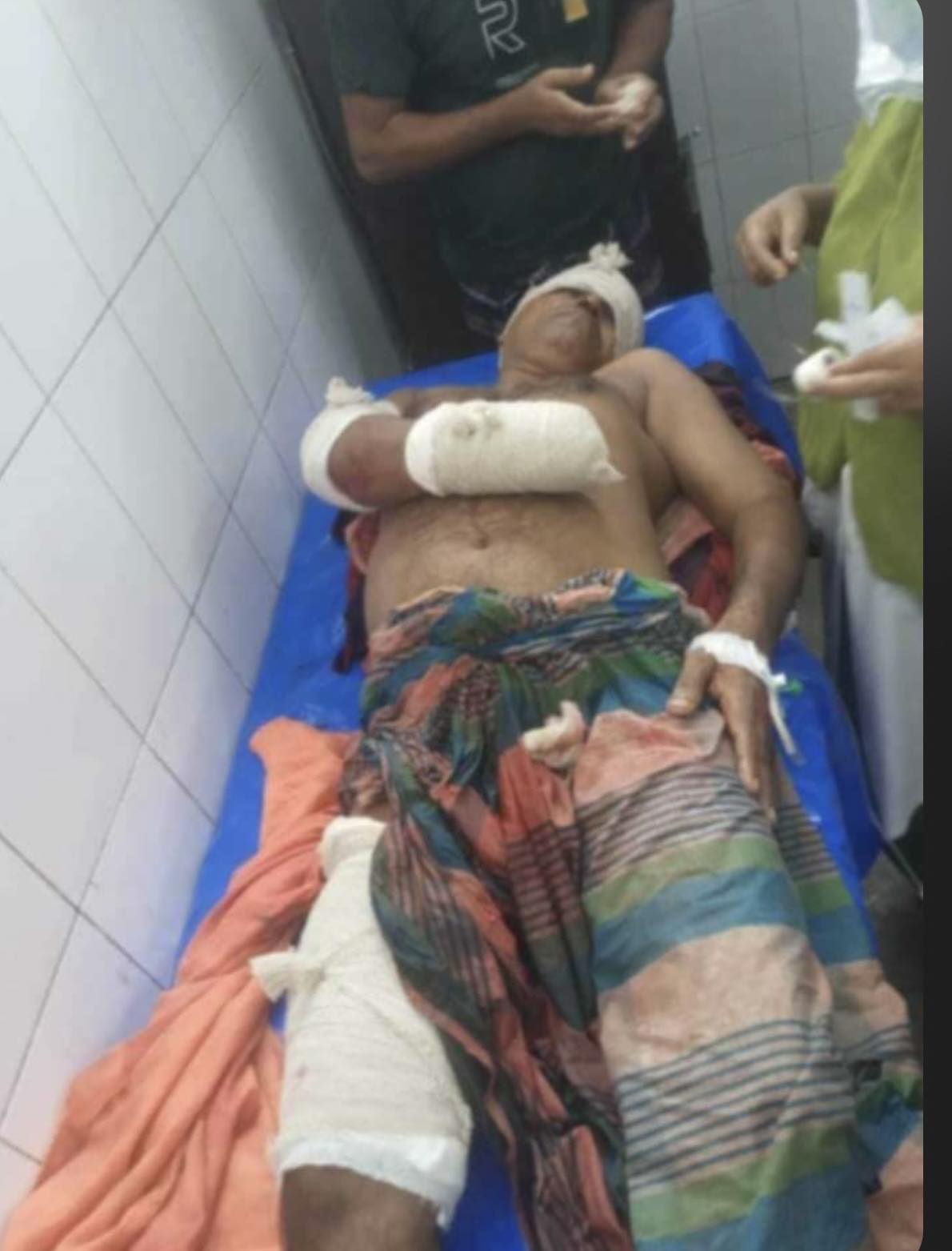 মেহেন্দিগঞ্জে বিএনপি নেতাকে কুপিয়ে হত্যার চেষ্টা, হাত ও গোপনাঙ্গ বিচ্ছিন্ন।
