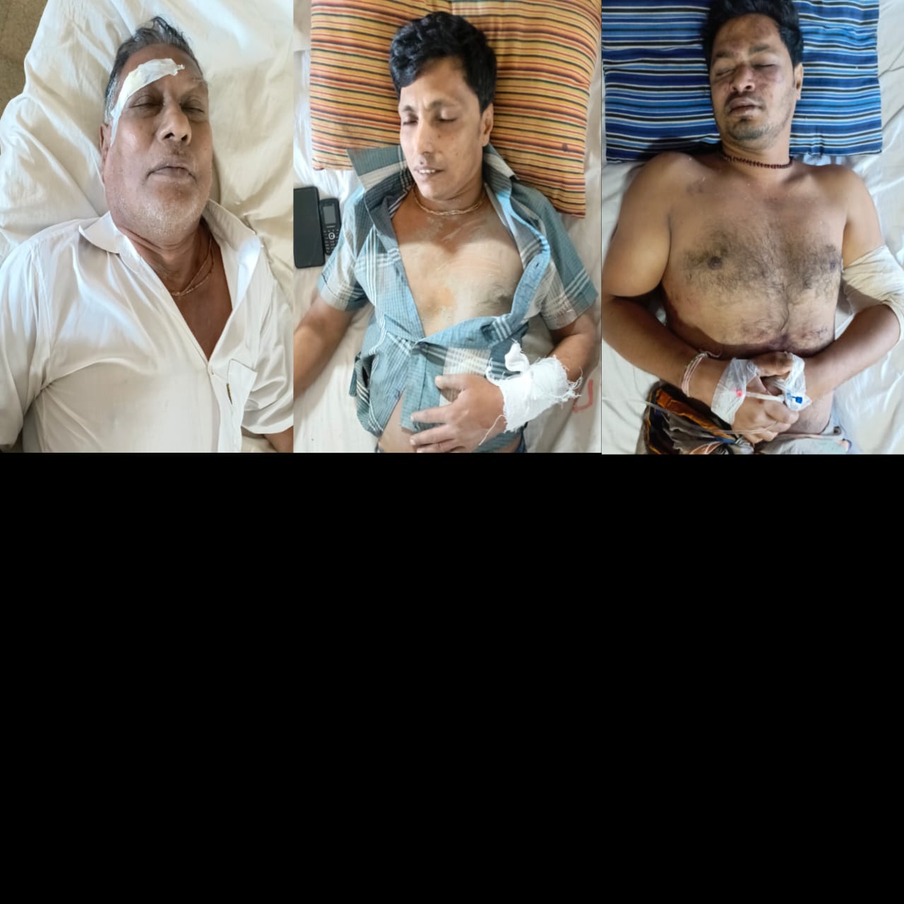বাউফলে জমির বিরোধে প্রতিপক্ষের হামলায় আহত ৫