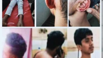 কুমিল্লা’য় ফুটবল খেলাকে কেন্দ্র করে দুই গ্রামবাসীর সংঘর্ষ,আহত-৬