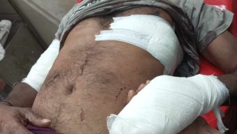 গলাচিপায় ভাইকে কুপিয়ে জখম করলো ভাই