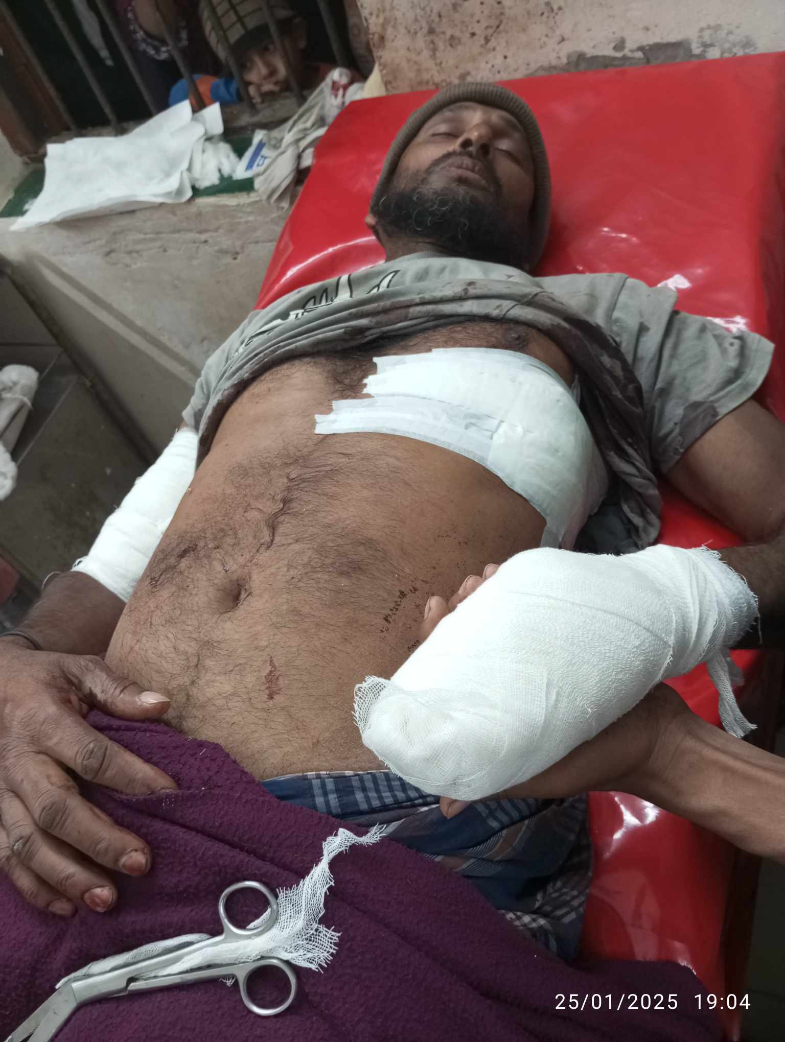 গলাচিপায় ভাইকে কুপিয়ে জখম করলো ভাই