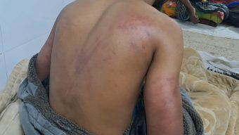 গোপালগঞ্জে মাদক ব্যবসা করতে না চাওয়ায় যুবককে মধ্যযুগীয় কায়দায় নির্যাতন