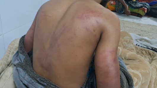 গোপালগঞ্জে মাদক ব্যবসা করতে না চাওয়ায় যুবককে মধ্যযুগীয় কায়দায় নির্যাতন