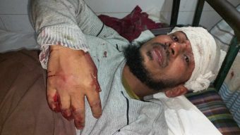মাদক সেবনে বাধা দেয়ায় কুপিয়ে জখম করা ব্যক্তির অবস্থা আশংকাজনক; থানায় মামলা