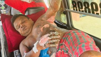 গোপালগঞ্জে গায়ে পেট্রোল ঢেলে হত্যার চেষ্টা, অগ্নিদগ্ধ-১