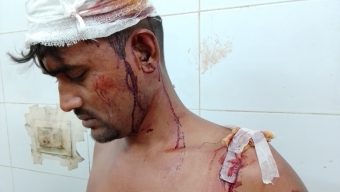 বিএনপি নেতার ইন্দনে যুবদল ও ছাত্রদলের দুই নেতাকে কুপিয়ে জখম!