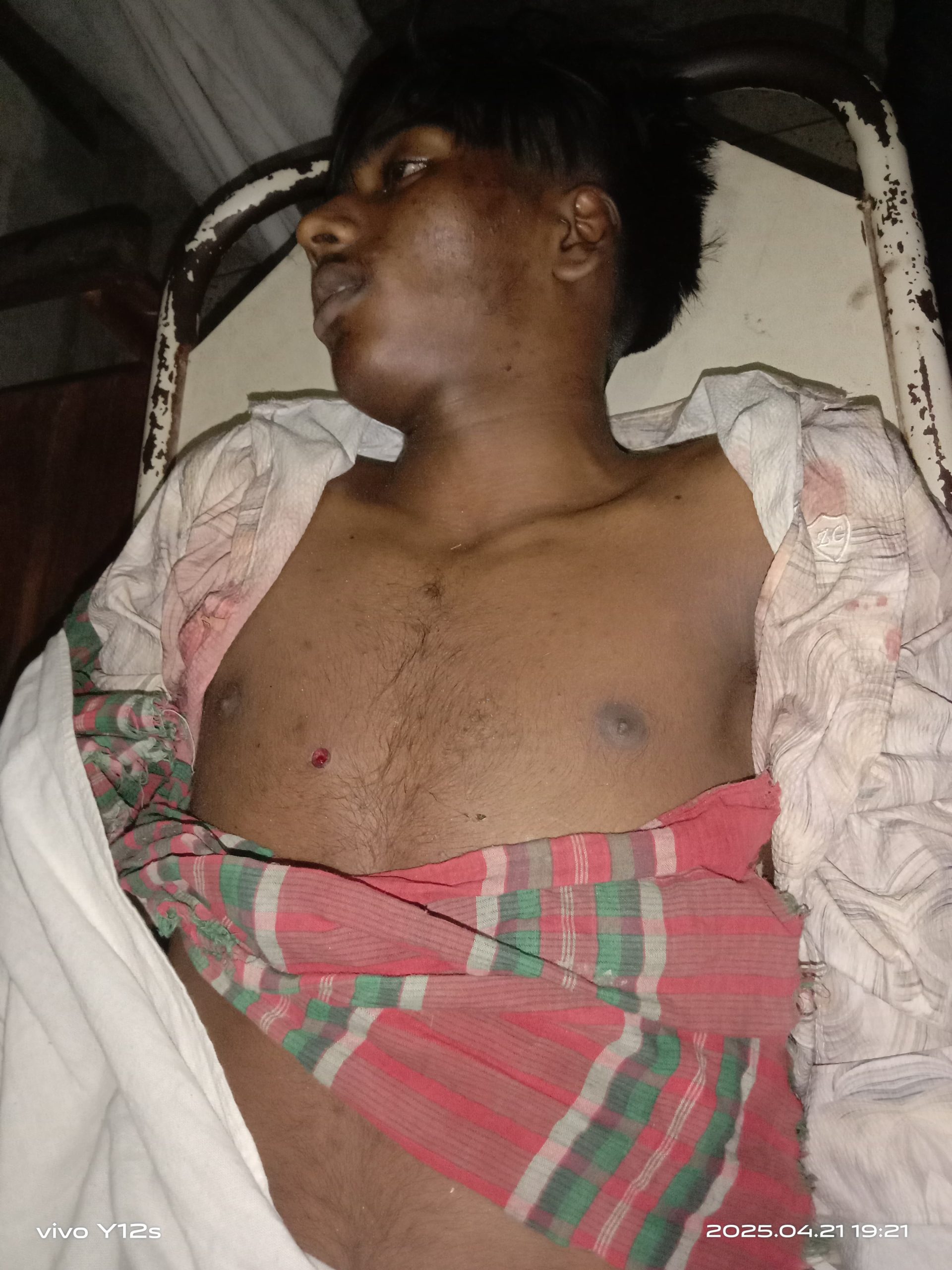বরিশালে র‌্যাবের ওপর হামলা গুলিতে মাদক ব্যবসায়ী নিহত