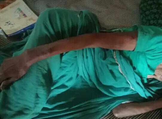 শাশুড়ী কে ঘরের ভিতর ঢুকে মারপিট ও হাতে কামড় দিয়ে রক্তাক্ত