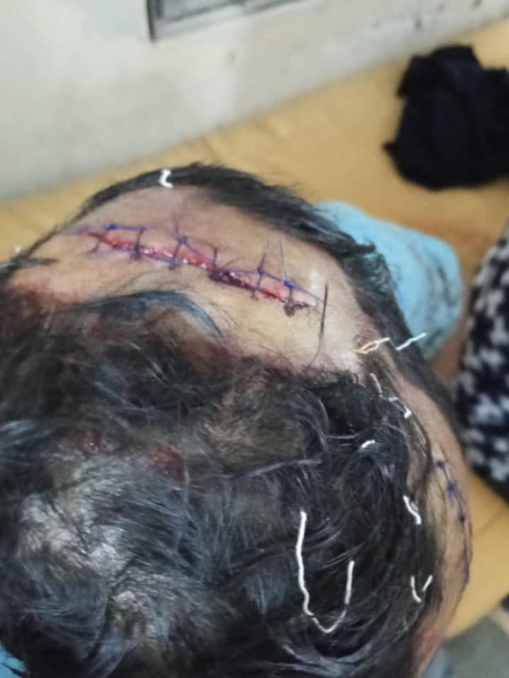 লালমোহনে আধিপত্য বিস্তারকে কেন্দ্র করে  বিএনপির ২ পক্ষের সংঘর্ষ আহত ৬, এখনো আতঙ্কে দিন কাটছে এলাকাবাসীর