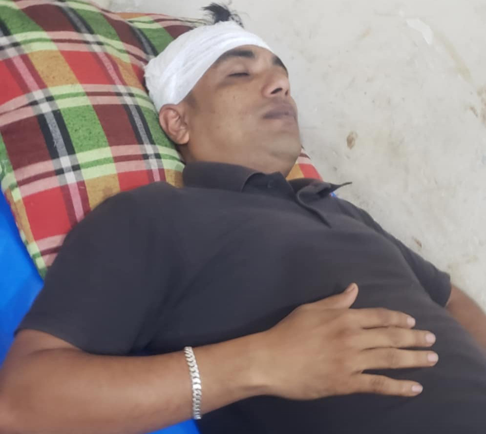 যুবদল কর্মীকে রক্তাক্ত জখম