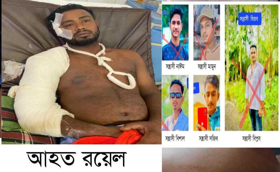 বালাগঞ্জের কালীগঞ্জ বাজারে সন্ত্রাসীদের আক্রমণে অতর্কিত হামলায় আহত-১