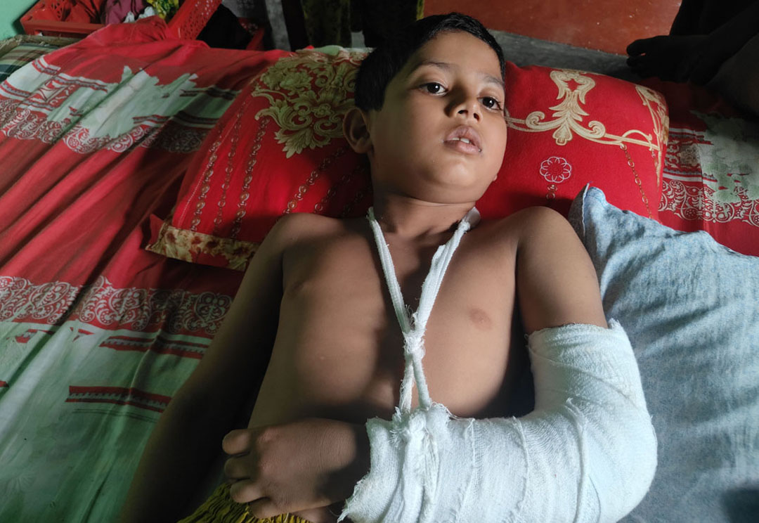 বেত দিয়ে পিটিয়ে ও ধাক্কা দিয়ে ফেলে মাদ্রাসা ছাত্রের হাত ভেঙ্গে ফেলার অভিযোগ মাদ্রাসা শিক্ষকের বিরুদ্ধে